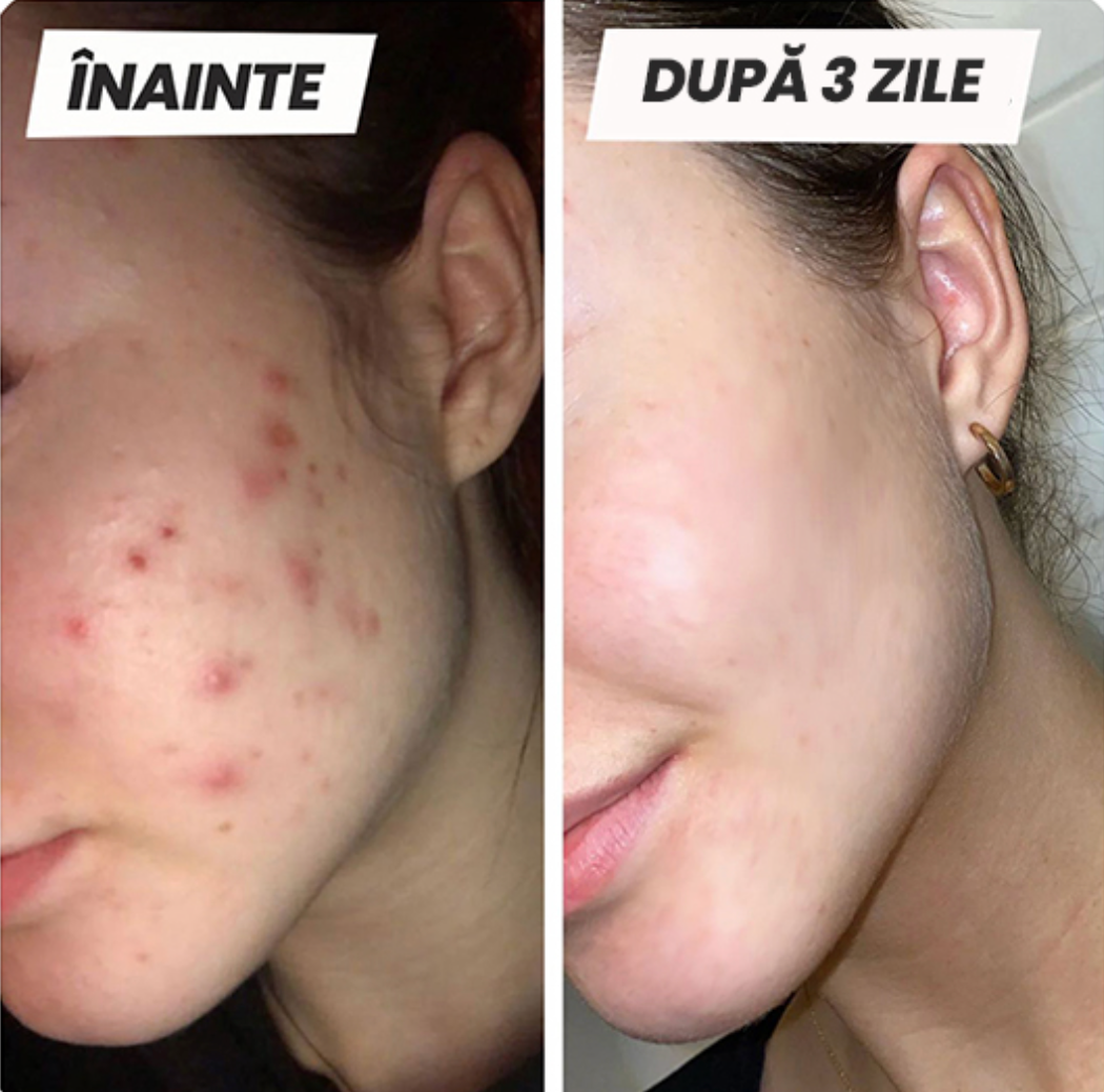 Skinévo Pro