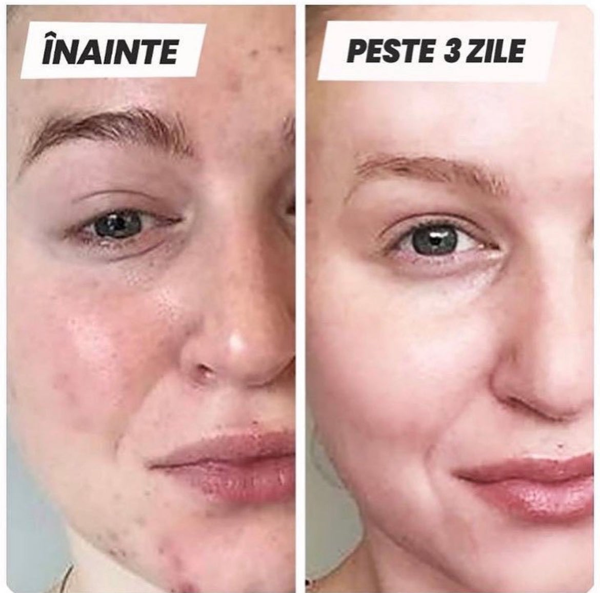 Skinévo mini Sun
