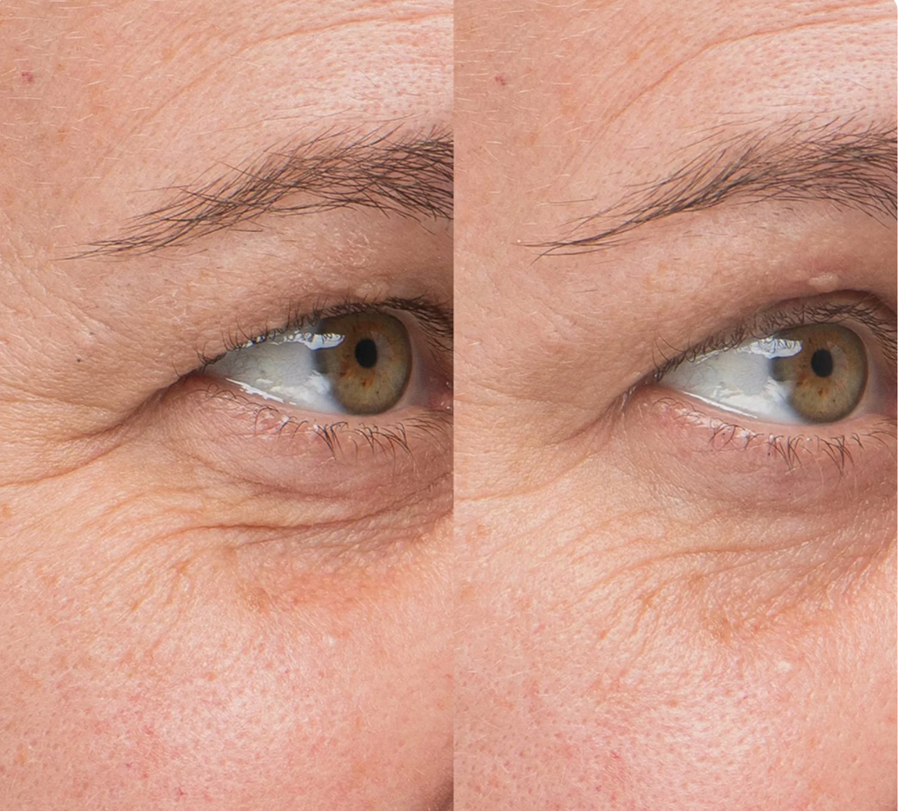 SkinGlow – Ser cu colagen