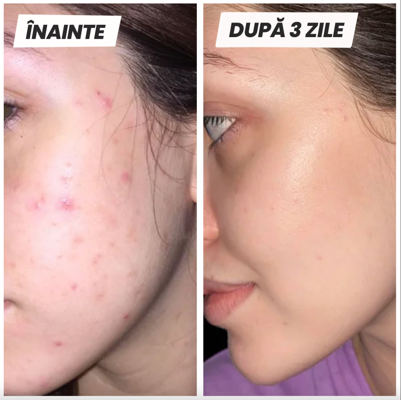 Skinévo mini Pink