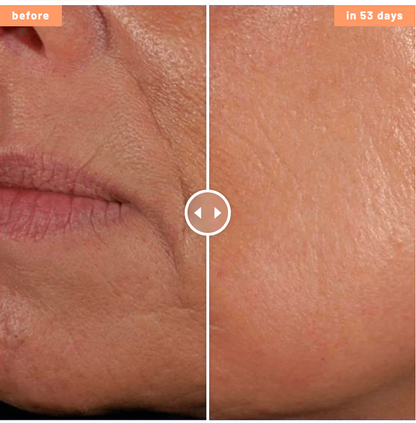 SkinGlow – Ser cu colagen