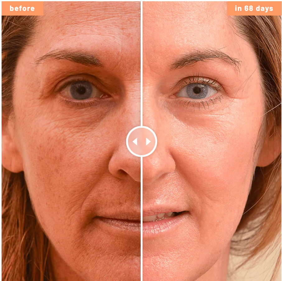 SkinGlow – Ser cu colagen