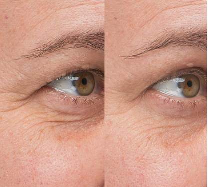 SkinGlow – Ser cu colagen