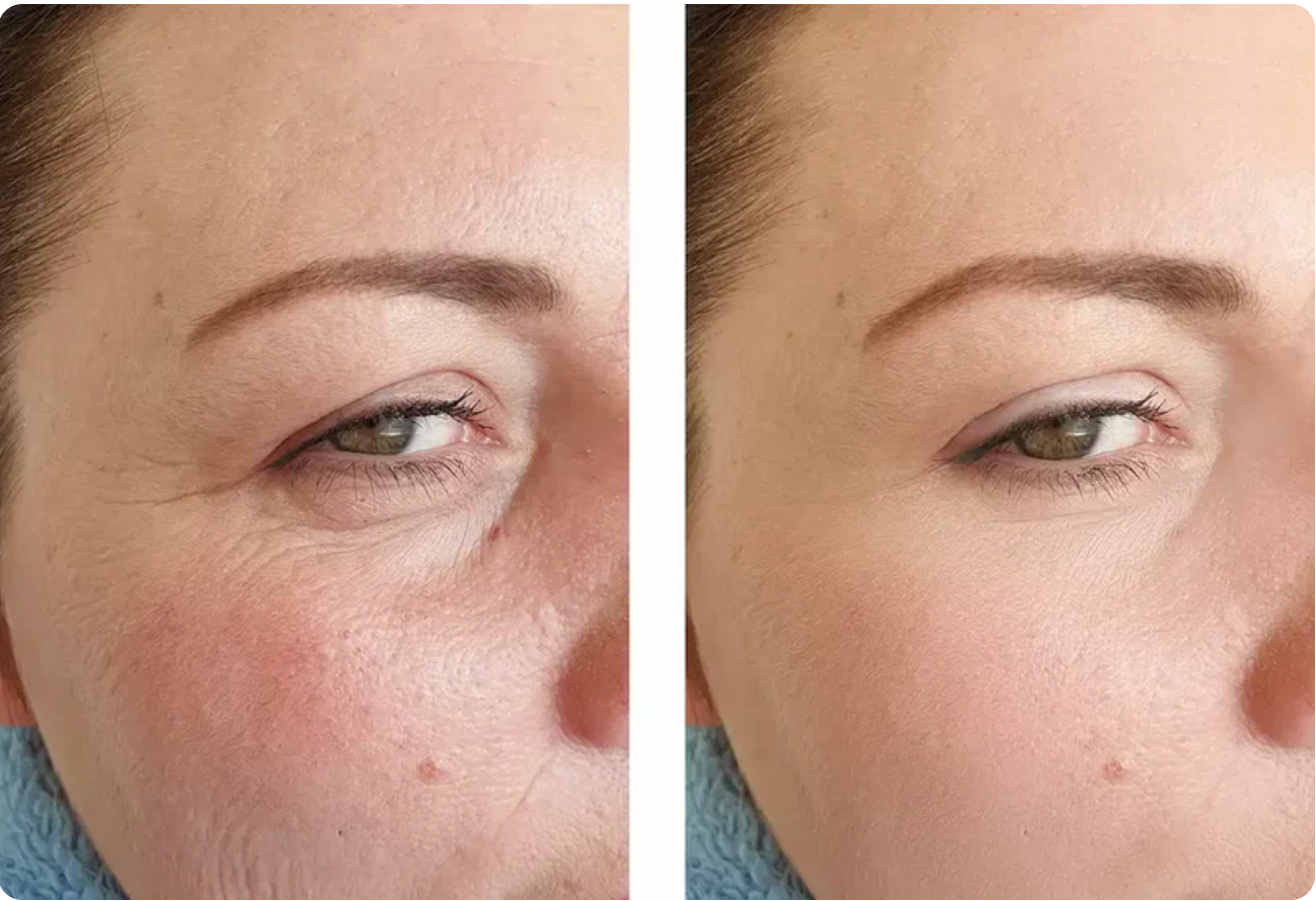 SkinGlow – Ser cu colagen